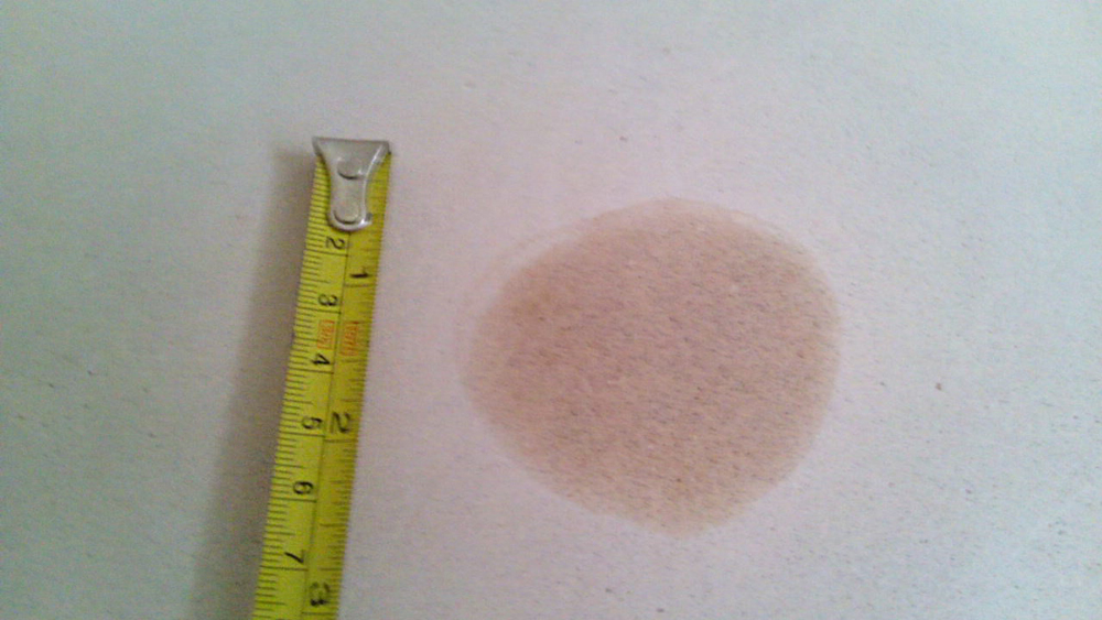 How To Cure Cold Spots On Internal Walls And External Walls Of