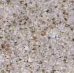 Shaw Stone for Sunrise Granite